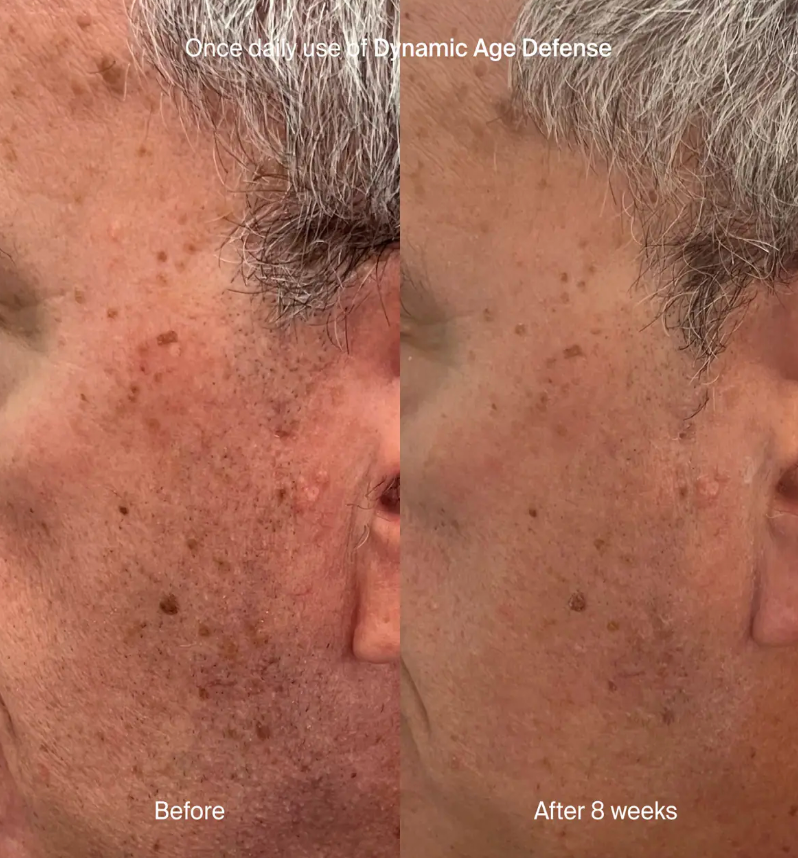 Dynamic Age Defense