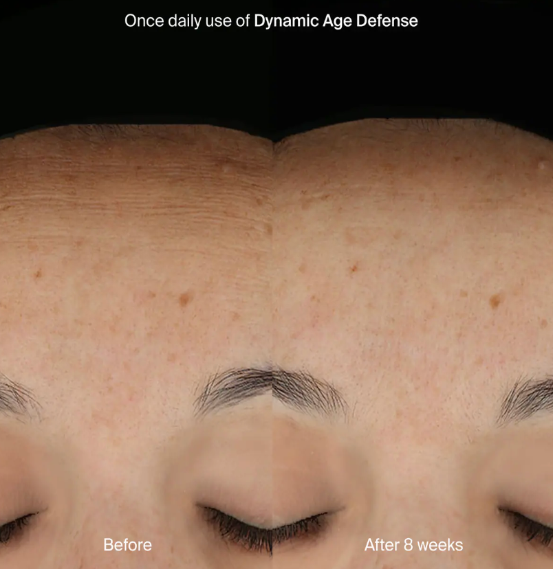 Dynamic Age Defense